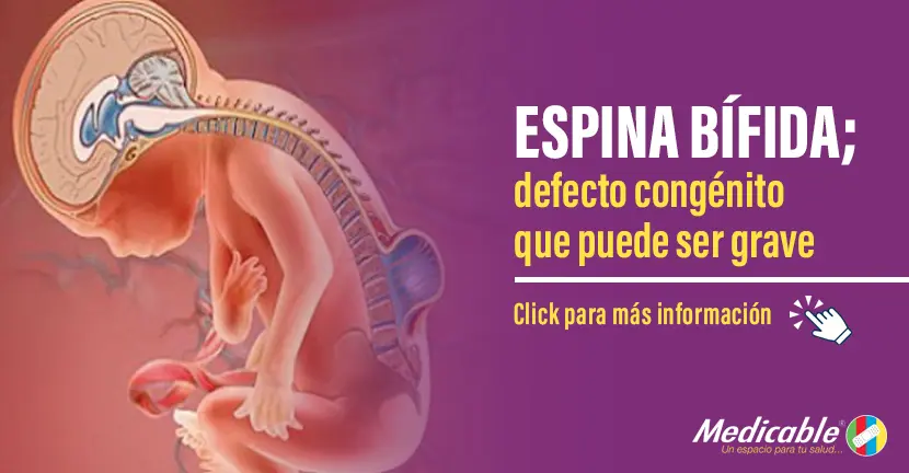 Espina Bífida, defecto congénito que puede ser grave