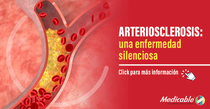 Arteriosclerosis, una enfermedad silenciosa