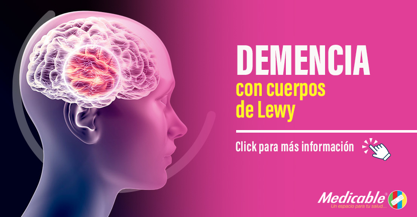 Demencia con cuerpos de Lewy