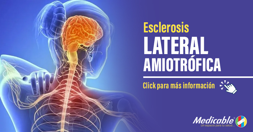 Esclerosis lateral amiotrófica