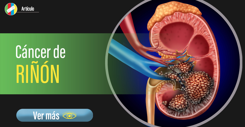 Cáncer de riñón