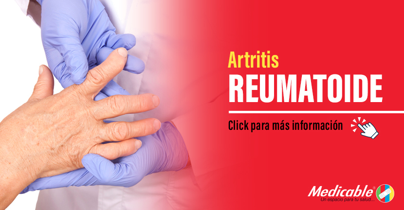 Artritis Reumatoide