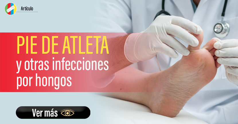 Pie de atleta y otras infecciones por hongos.