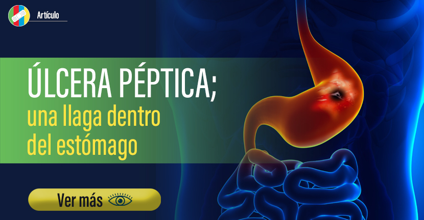 Úlcera péptica, una llaga dentro del estómago.