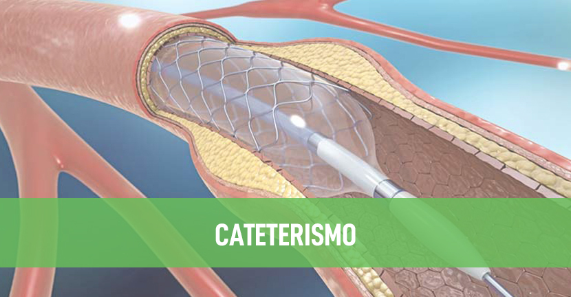 Cateterismo