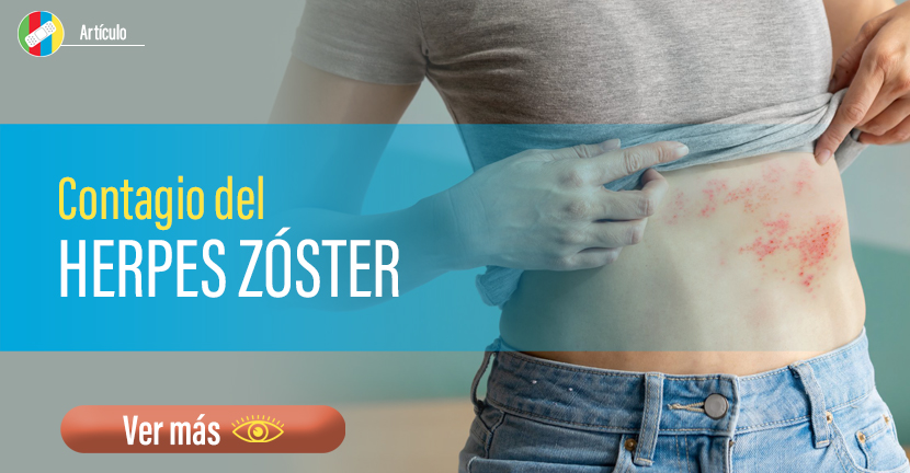 Contagio del Herpes Zóster