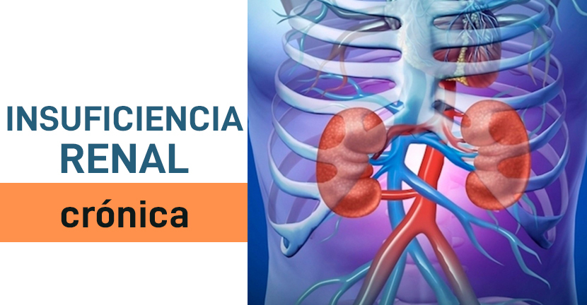 Insuficiencia renal crónica