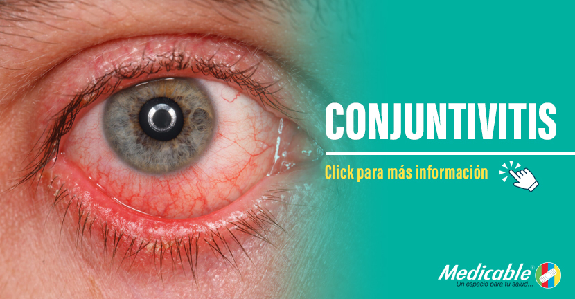 Conjuntivitis