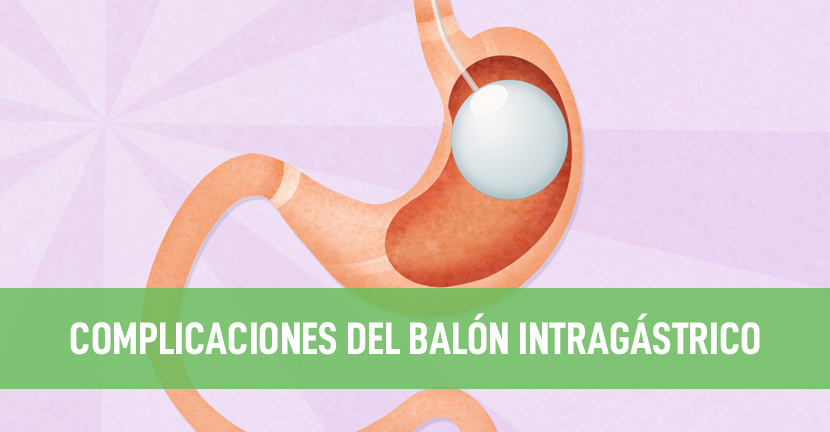 Complicaciones del balón intragástrico