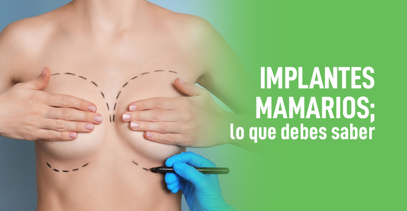 Implantes mamarios, lo que debes saber