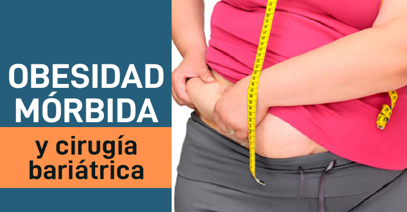 Obesidad mórbida y cirugía bariátrica