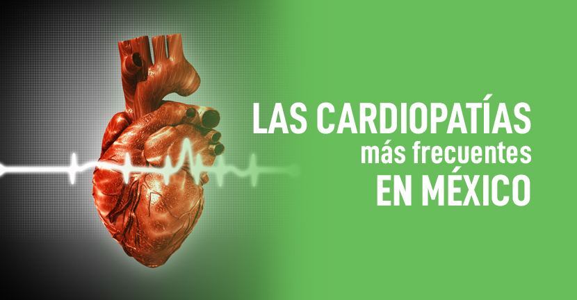 Las cardiopatías más frecuentes en México