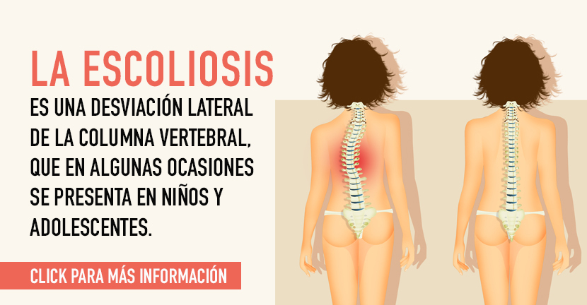 Escoliosis en niños o adolescentes