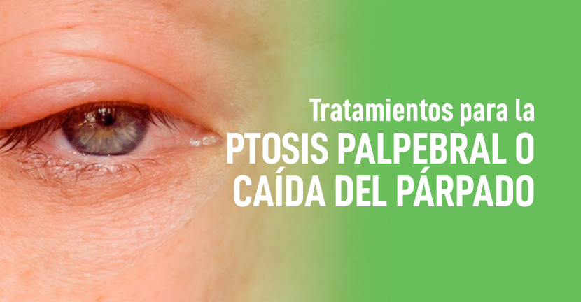 Tratamientos para la ptosis palpebral o caída del párpado