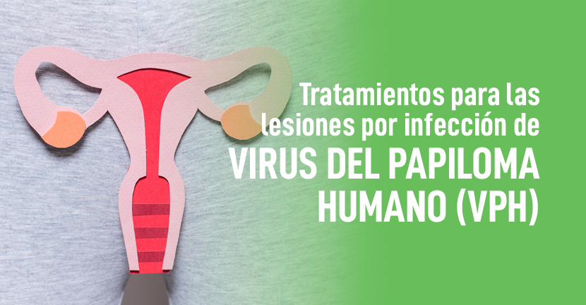 Tratamientos para las lesiones por infección de Virus del Papiloma Humano (VPH)