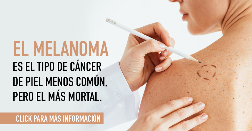 Melanoma