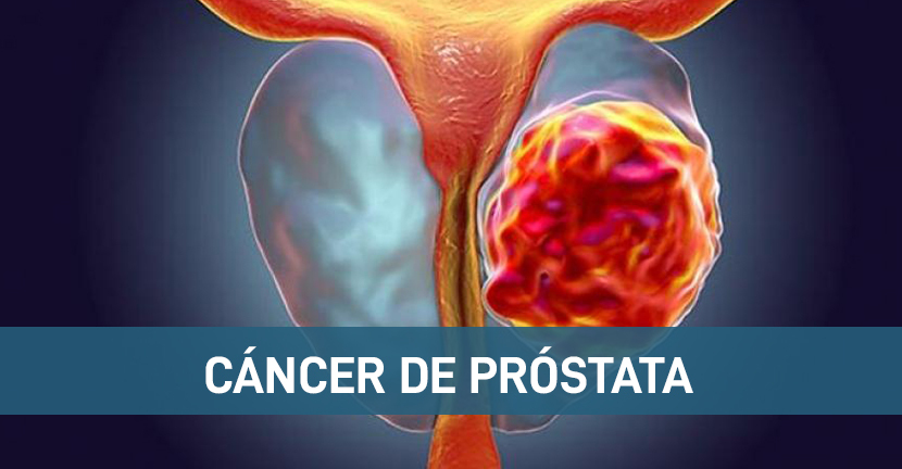 Cáncer de prostático