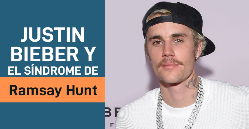 Justin Bieber y el síndrome de Ramsay Hunt
