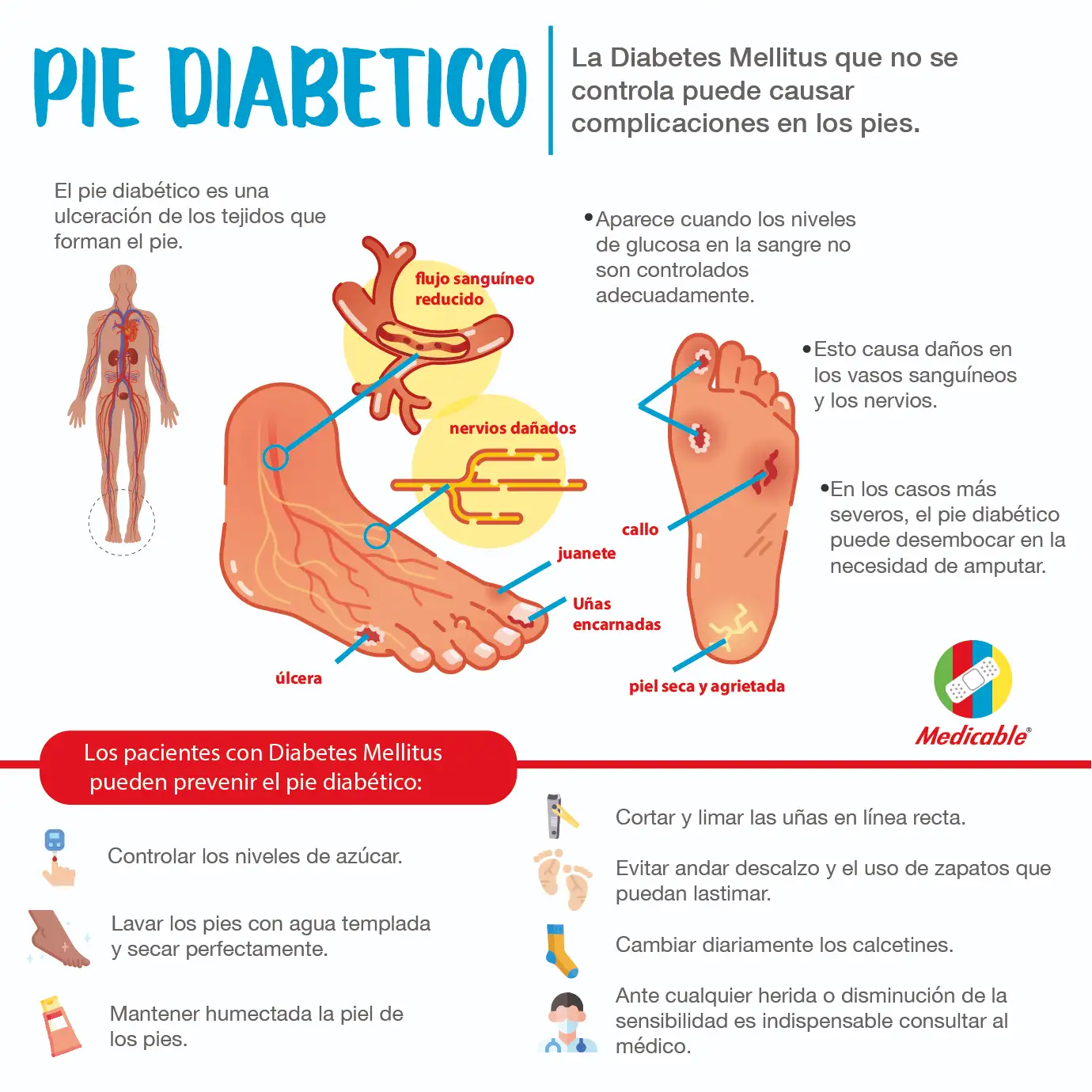 Pie diabetico