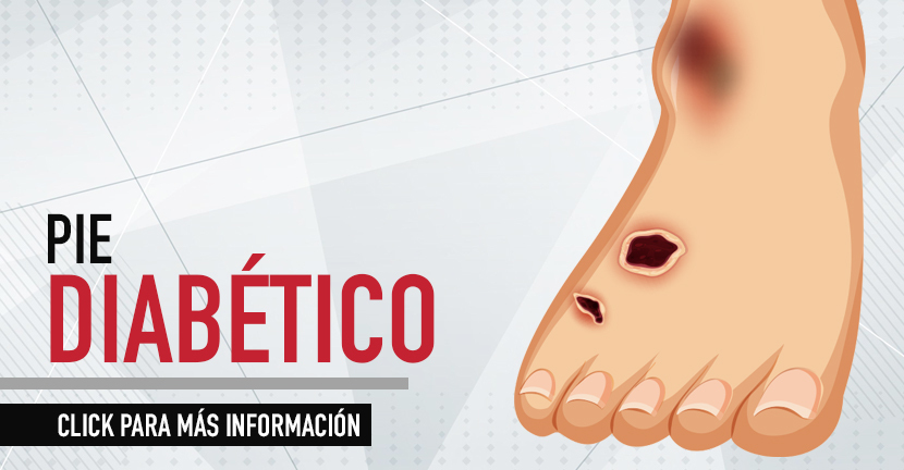 Pie diabetico