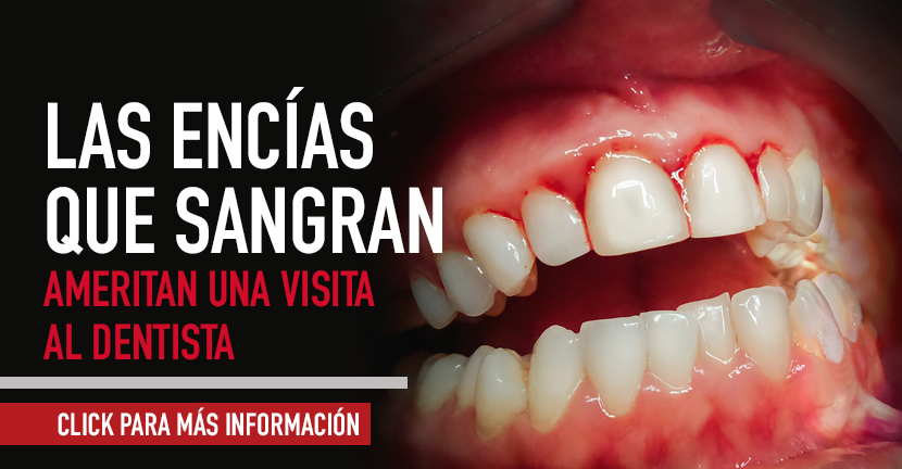 Encías Sangrantes