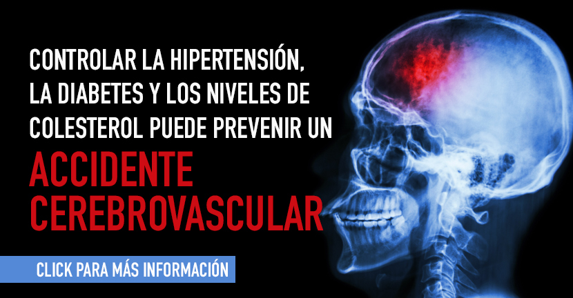 Accidente cerebrovascular