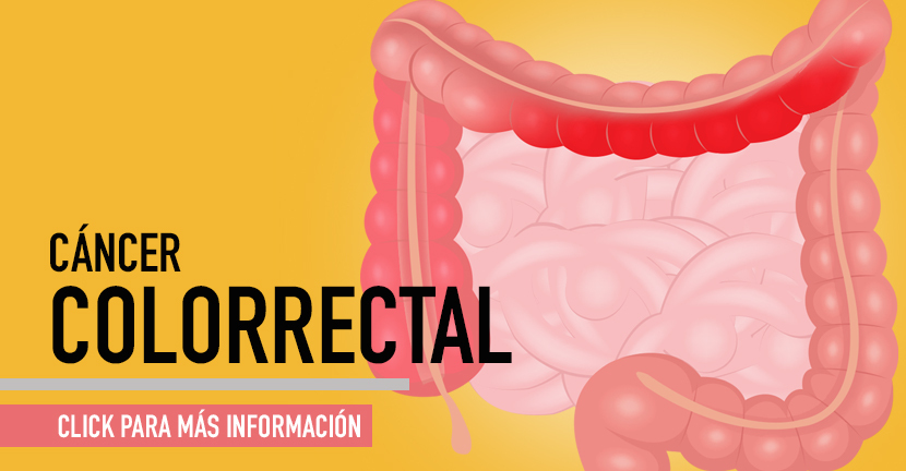 Cáncer colorrectal 