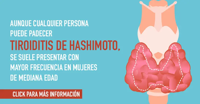 Tiroiditis de Hashimoto