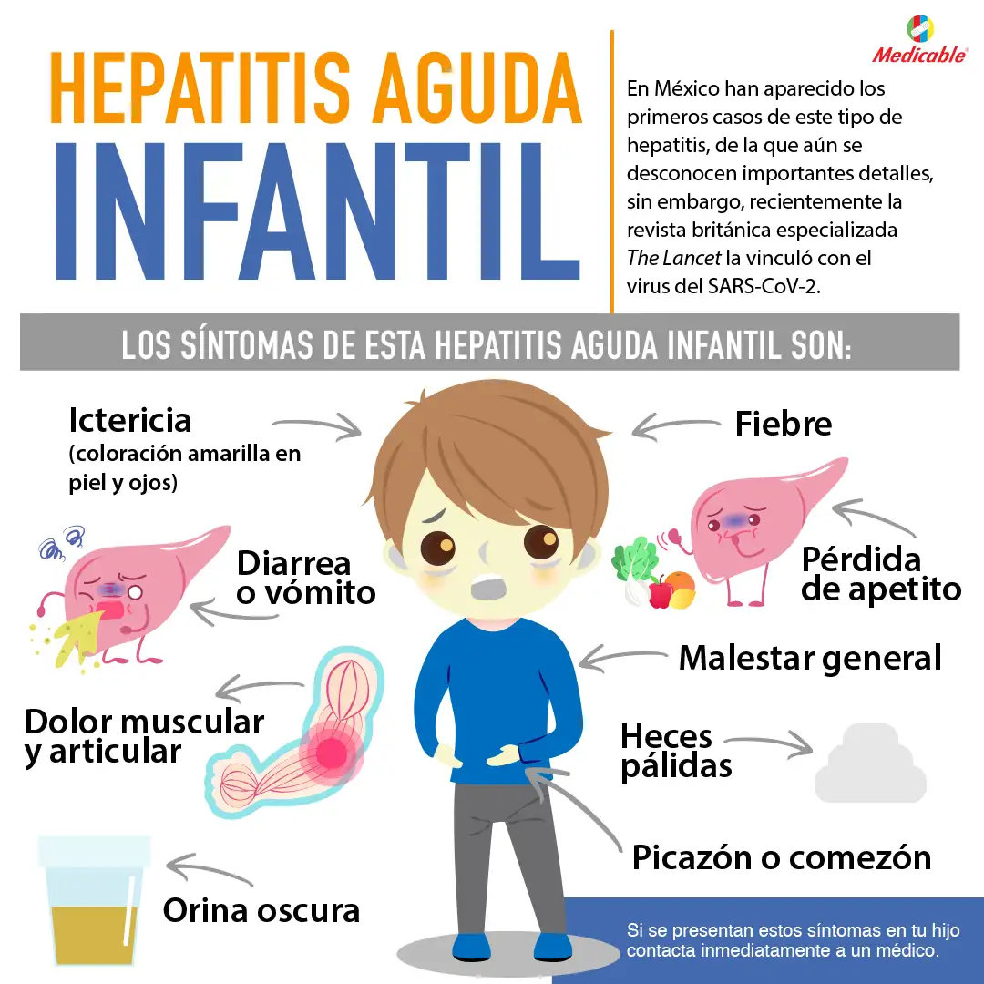 Hepatitis Aguda infantil