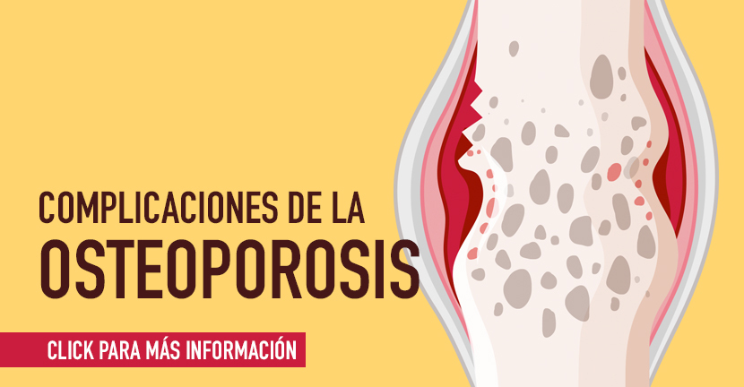 Complicaciones de la osteoporosis