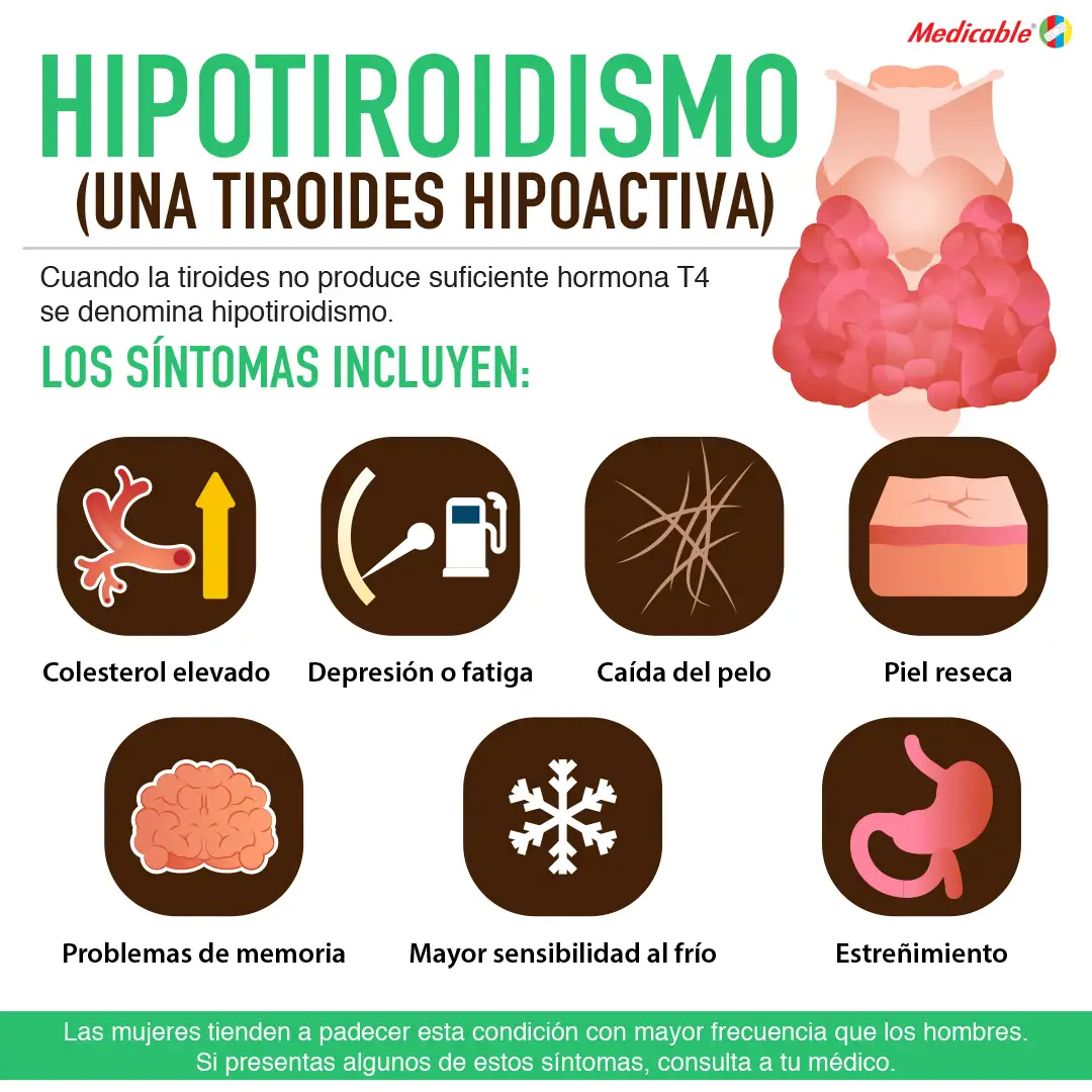 Hipotiroidismo una tiroides hipoactiva