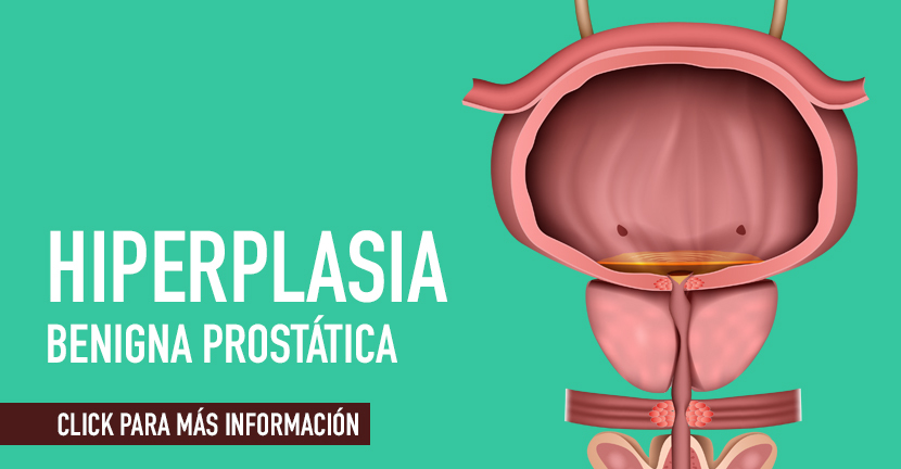 Hiperplasia benigna prostática