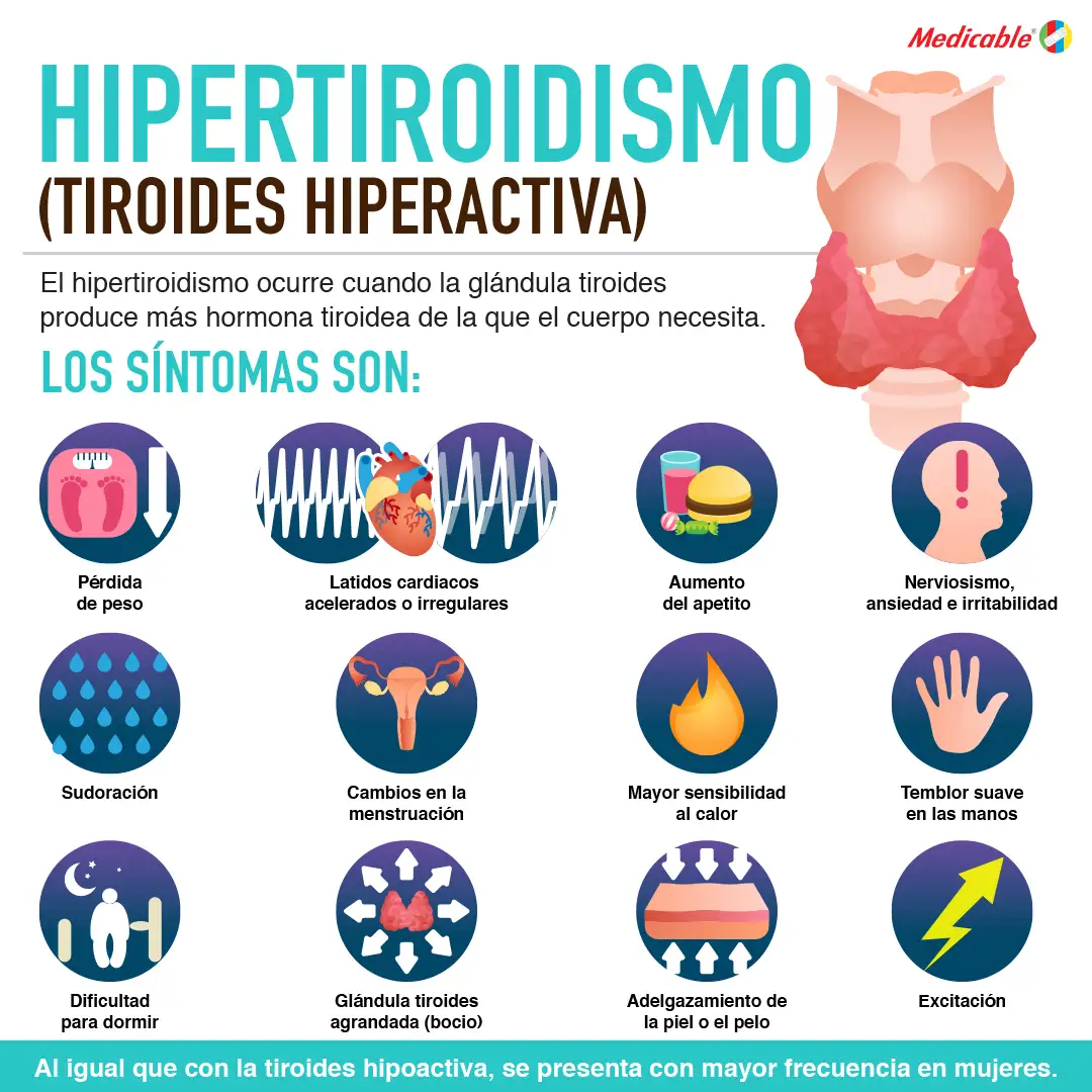 Hipertiroidismo