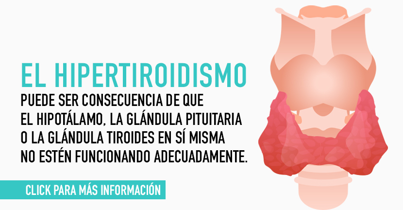 Hipertiroidismo