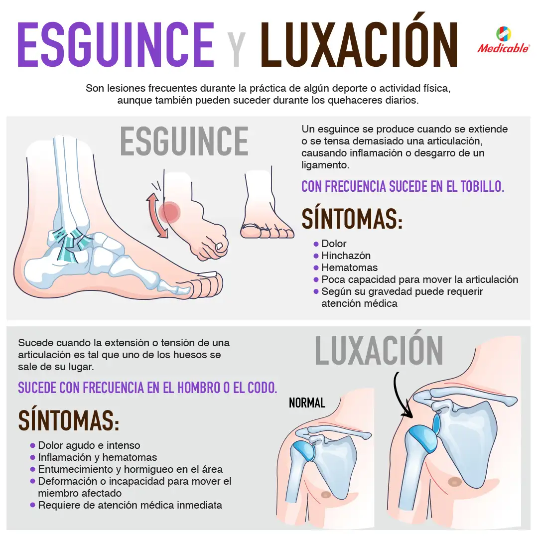 Esguince y luxación 