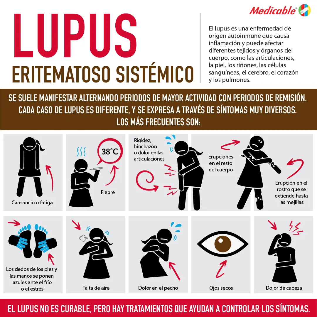 Lupus