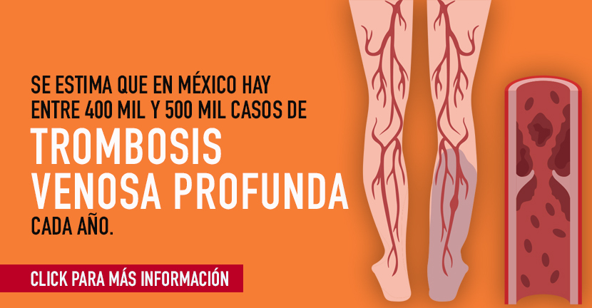 Trombosis venosa profunda