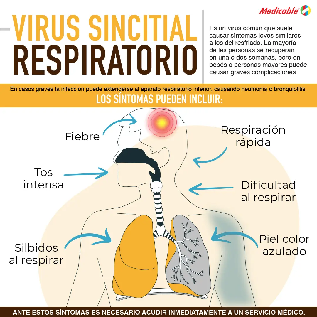 Virus sincitial respiratorio