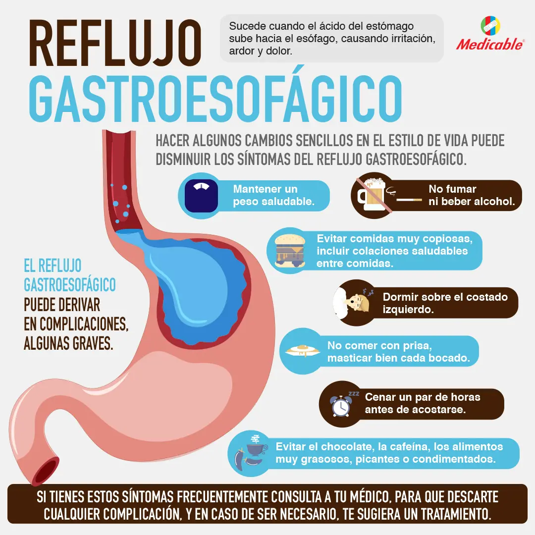 Reflujo gastroesofágico
