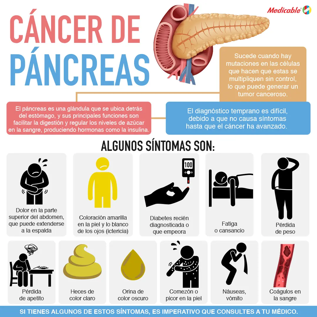 Cáncer de pancreas