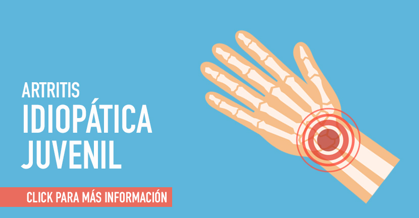 Artritis ideopática juvenil 