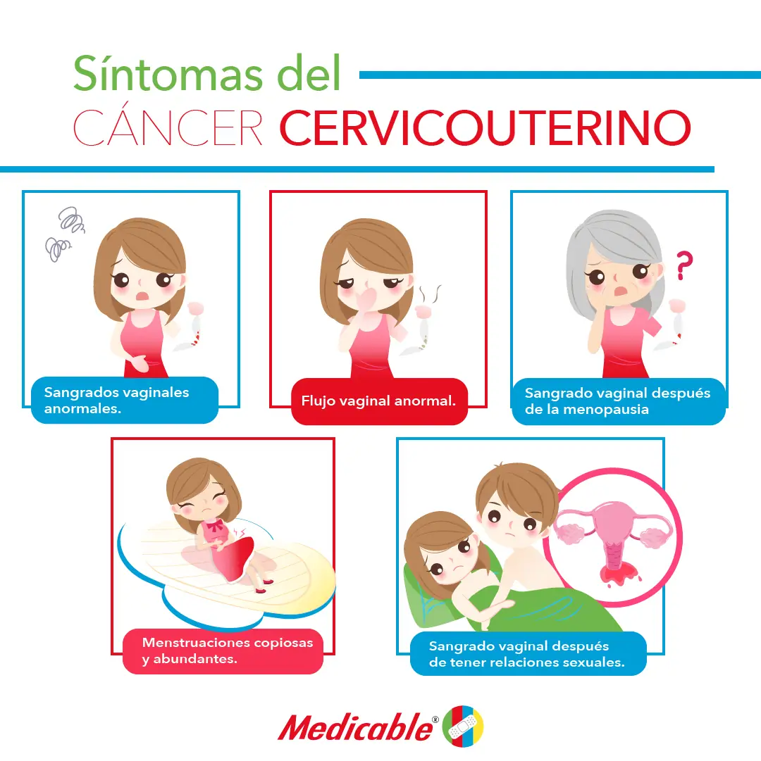Síntomas del cáncer cervicouterino