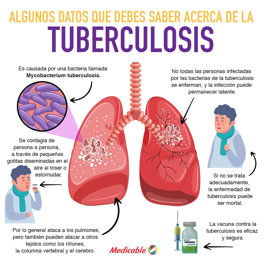 Algunos datos acerca de la tuberculosis