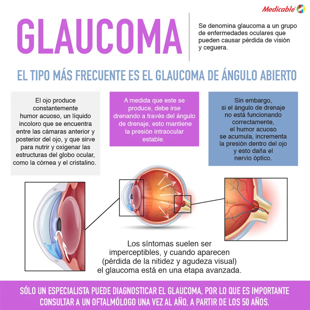 Glaucoma