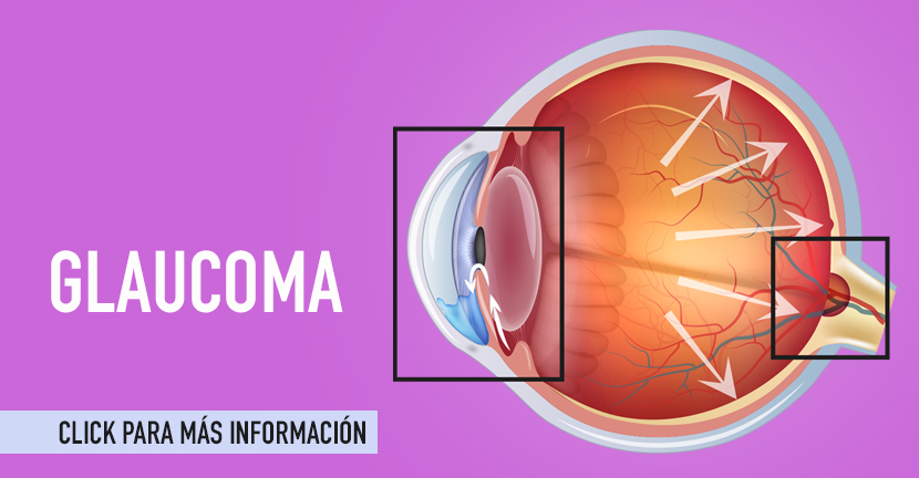 Glaucoma