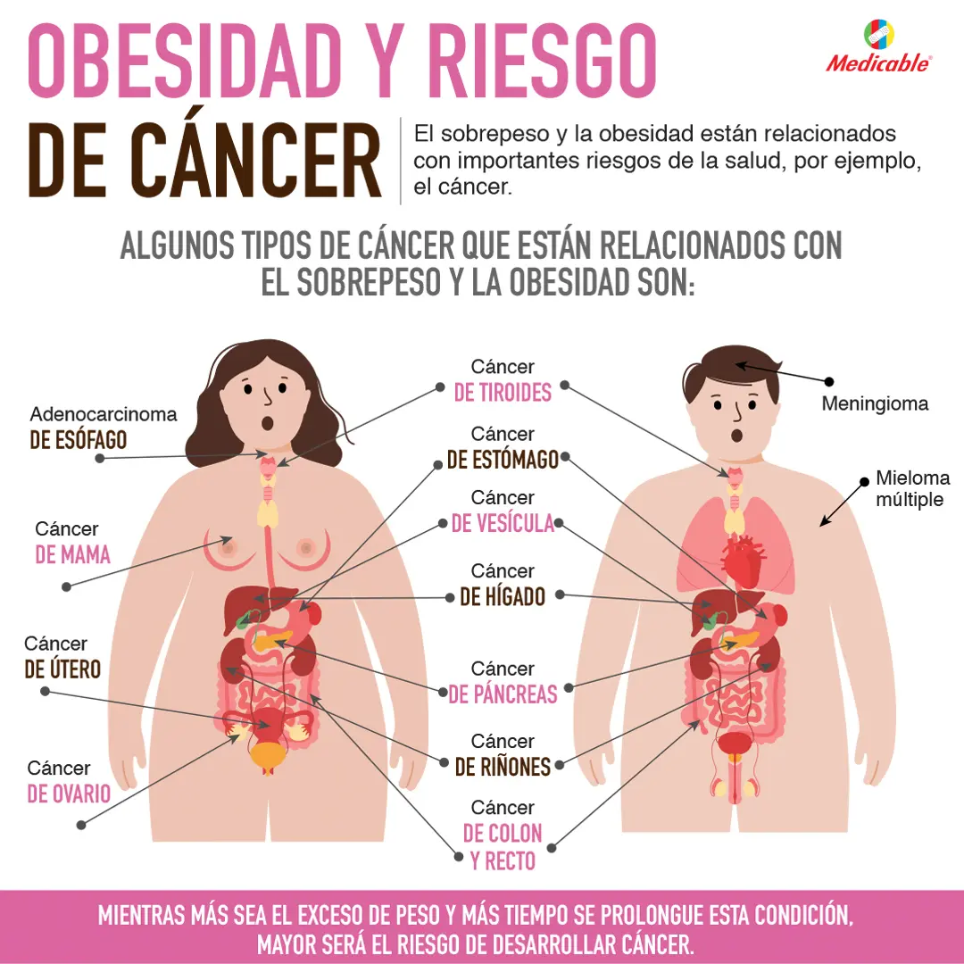 Obesidad y riesgo de cáncer
