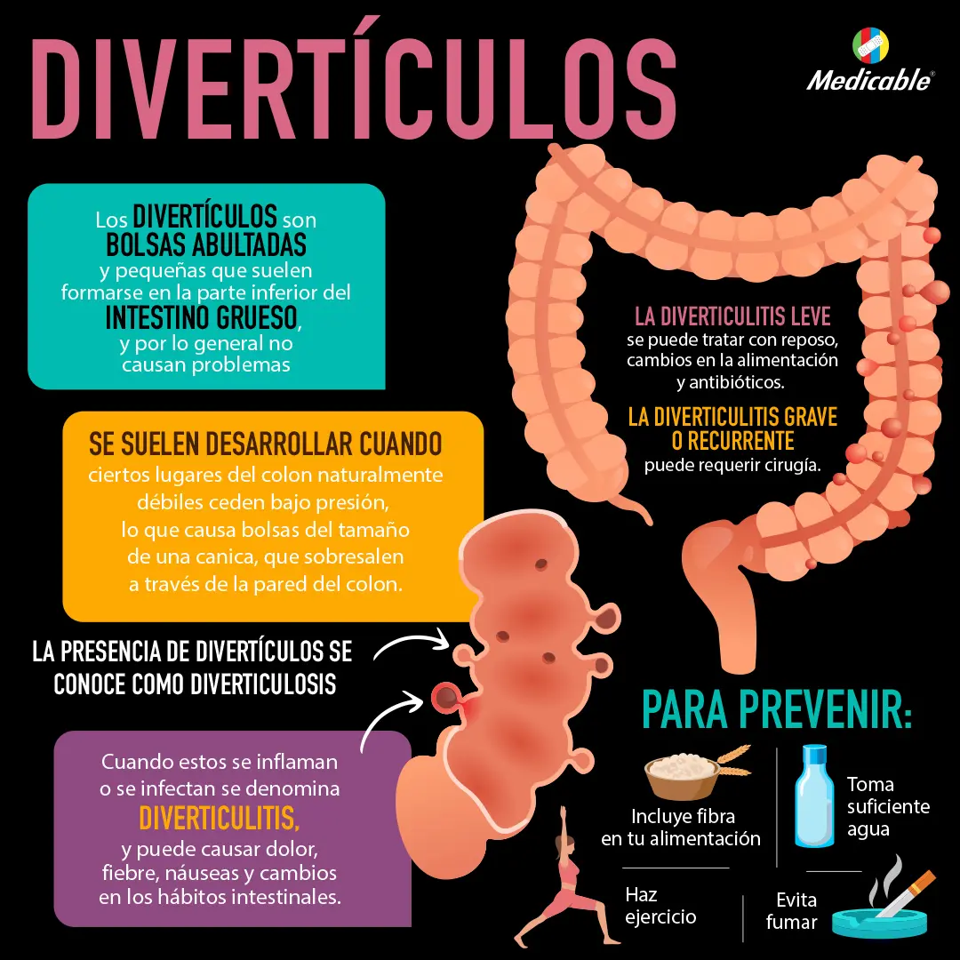 Divertículos