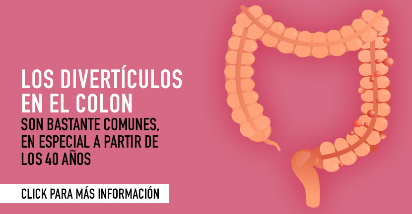 Divertículos