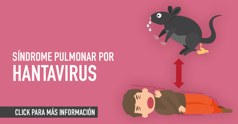 Síndrome pulmonar por Hantavirus