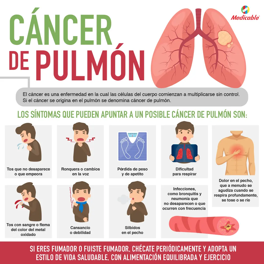 Cáncer de pulmón